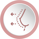 Mamoplastia