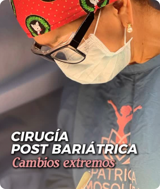 Resultado Torsoplastia
