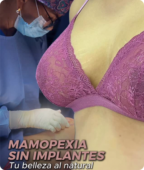 Resultado Mastopexia sin Implantes
